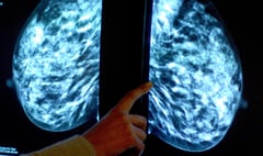 Thousands of Hampshire women miss “vital” breast cancer screenings