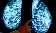 Thousands of Hampshire women miss “vital” breast cancer screenings
