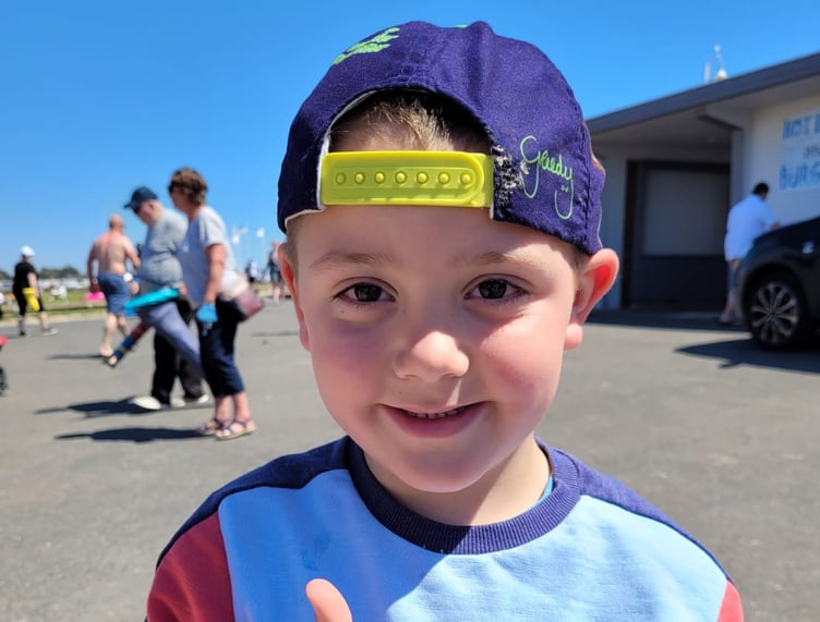 Oscar Hutton, then aged three, fell 12 feet onto a tiled floor at his grandparents’ home in May 2019