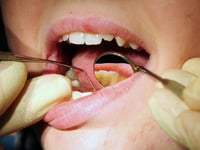 Nearly a third of people in Hampshire and the Isle of Wight struggle to get an NHS dentist appointment