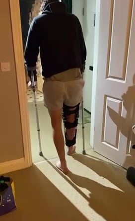 Video grab of Regan Hitch walking on crutches. Photo released November 24 2024. Best friend sets up a GoFundMe for man who torn three out of the four ligaments in his knee.Olly Dickson, 28, was horrified on the 13 the November as he witnessed two of his friends collide at a training match for Alton Phoenix FC.Alton Phoenix are a step five football team located in Alton, Hampshire. Regan Hitch, 28, recently joined the team with a bag of experience at Semi- pro levels.Unfortunately, it looks as though his footballing career is sadly coming to an end. 'Reggie' completely tore three of the four major ligaments in his knee. His ACL, MCL, and cruciate, and only one ligament was left holding it all together.
