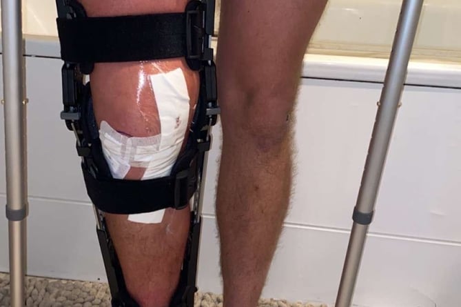 Regan Hitch on crutches. Photo released November 24 2024. Best friend sets up a GoFundMe for man who torn three out of the four ligaments in his knee.Olly Dickson, 28, was horrified on the 13 the November as he witnessed two of his friends collide at a training match for Alton Phoenix FC.Alton Phoenix are a step five football team located in Alton, Hampshire. Regan Hitch, 28, recently joined the team with a bag of experience at Semi- pro levels.Unfortunately, it looks as though his footballing career is sadly coming to an end. 'Reggie' completely tore three of the four major ligaments in his knee. His ACL, MCL, and cruciate, and only one ligament was left holding it all together.
