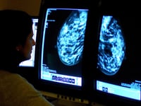 More women in Hampshire undergo breast cancer screening – as NHS England target met for first in five years