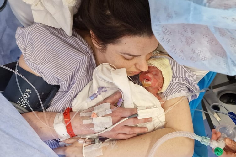 Benji Sandham in hospital when first born with mom Laura.  A baby born at just 26 weeks who was the same size as his soft toy has made a miracle recovery - and now dwarfs his beloved bunny.  Little Benji Sandham, now 11 months old, weighed just 1lbs 14oz when he was born 14 weeks early on April 17, 2024. Benji had to have an emergency surgery at two days old to repair a hole in his bladder and spent 10 weeks in hospital, gaining his strength.   But his parents, Laura Nelson, 35, and Adam Sandham, 30, had to rush him back to hospital at four months old when his legs turned purple and his blood pressure shot up.  Investigative tests later diagnosed Benji with cerebral palsy and he is undergoing physiotherapy to help give him the best chance at mobility.  The tiny tot is still the same size as a three-month-old but is "relaxed" and "happy" and still loves his soft toy bunny.