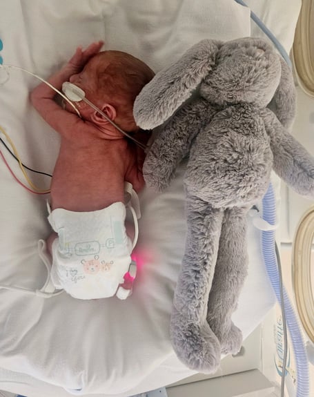Benji Sandham in hospital when first born next to his bunny toy.  A baby born at just 26 weeks who was the same size as his soft toy has made a miracle recovery - and now dwarfs his beloved bunny.  Little Benji Sandham, now 11 months old, weighed just 1lbs 14oz when he was born 14 weeks early on April 17, 2024. Benji had to have an emergency surgery at two days old to repair a hole in his bladder and spent 10 weeks in hospital, gaining his strength.   But his parents, Laura Nelson, 35, and Adam Sandham, 30, had to rush him back to hospital at four months old when his legs turned purple and his blood pressure shot up.  Investigative tests later diagnosed Benji with cerebral palsy and he is undergoing physiotherapy to help give him the best chance at mobility.  The tiny tot is still the same size as a three-month-old but is "relaxed" and "happy" and still loves his soft toy bunny.