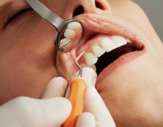 Hampshire NHS increases dental appointments